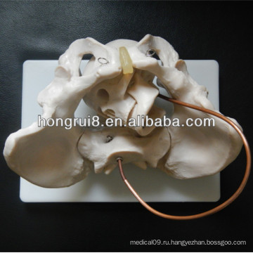 ISO Anatomy Pelvis Модель с эмбриональным черепом, модель демонстрации рождения